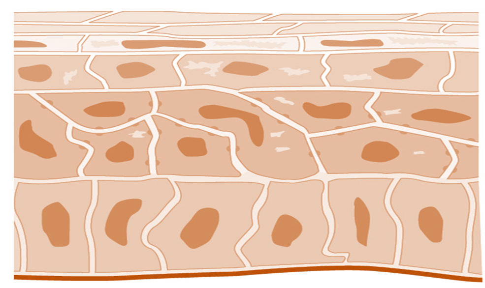 keratinocytes